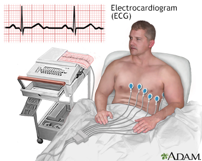 myocardial infarction symptoms myocardial infarction symptoms