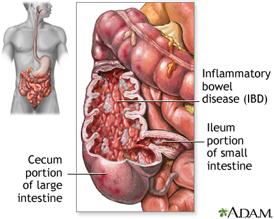 heart attack pain location. even a heart attack can