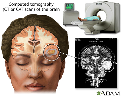 Ct+scan+brain+anatomy
